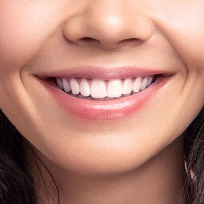 Pearly Whites: 5 Health Benefits of Straight Teeth You Need to Know About
