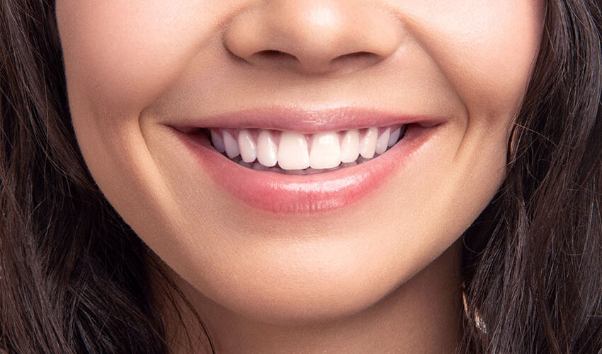Pearly Whites: 5 Health Benefits of Straight Teeth You Need to Know About